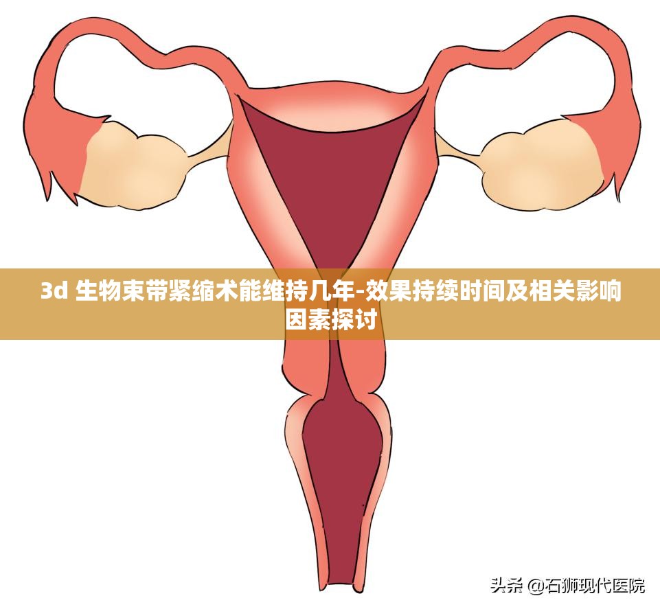 3d 生物束帶緊縮術(shù)能維持幾年-效果持續(xù)時(shí)間及相關(guān)影響因素探討