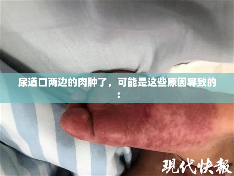 尿道口兩邊的肉腫了，可能是這些原因導致的：