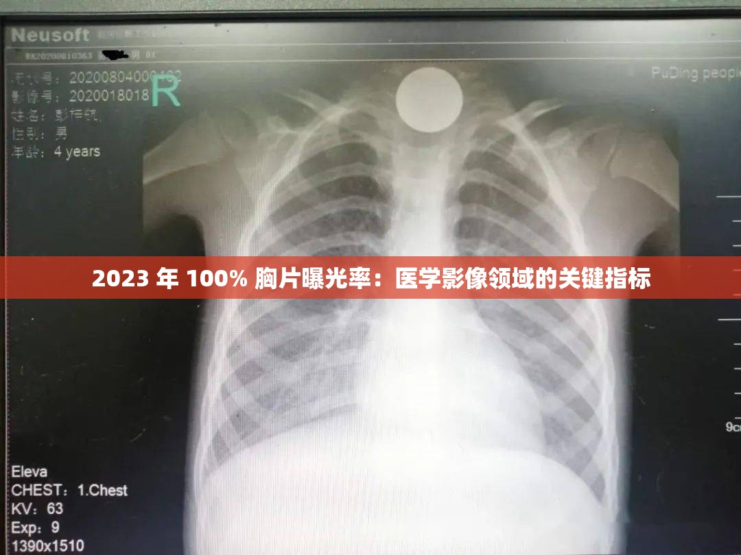 2023 年 100% 胸片曝光率：醫(yī)學影像領域的關鍵指標