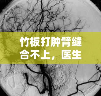 竹板打腫臂縫合不上，醫(yī)生稱情況罕見(jiàn)